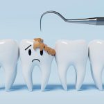 怖い歯の病気『むし歯』発生のメカニズムをご存じですか？