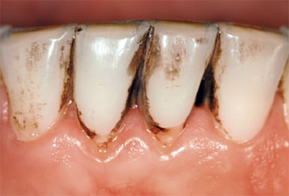 エアフローハンディー