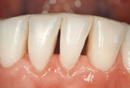 エアフローハンディー